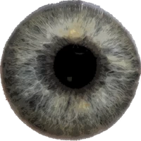 Eye Diagnosis